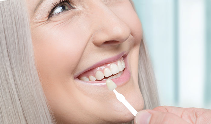 A woman smiling with her new dental veneers