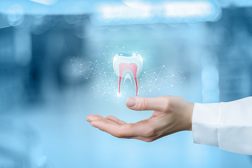 Diagram of a same day dental crown